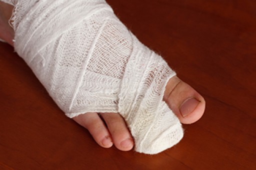 What to Know About a Broken Toe