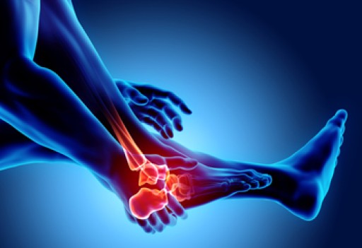 Arthritic Foot Care