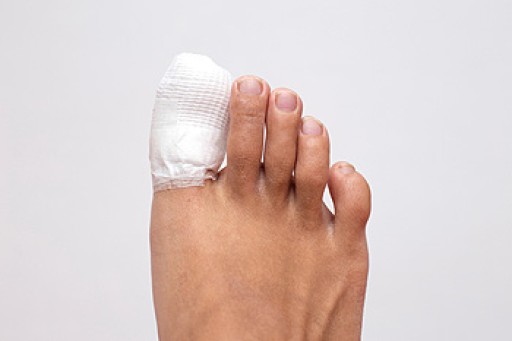 What to Know About a Broken Toe
