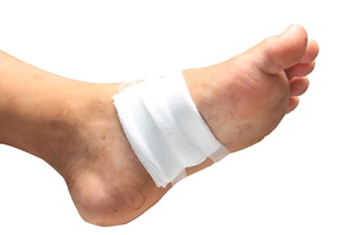 What Is a Puncture Wound?