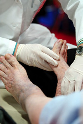 How to Care for Diabetic Foot